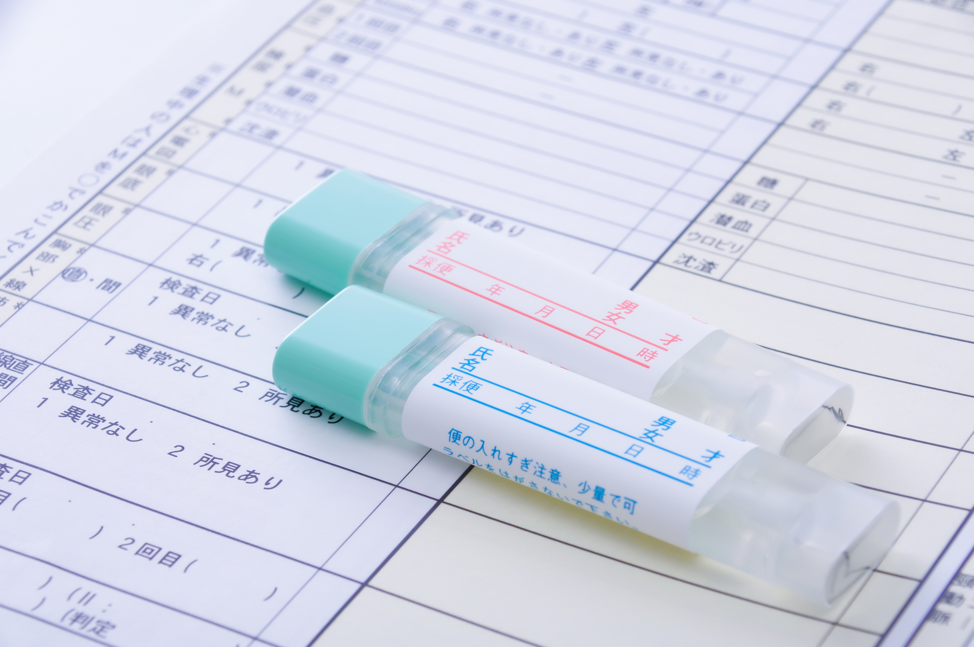便潜血検査で陽性と判定されたらどうする？病気の可能性と次のステップを解説